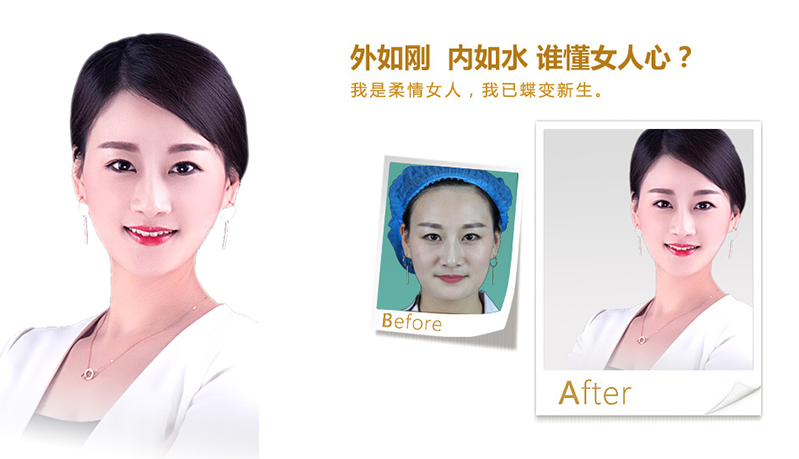 潍坊V脸、线雕隆鼻